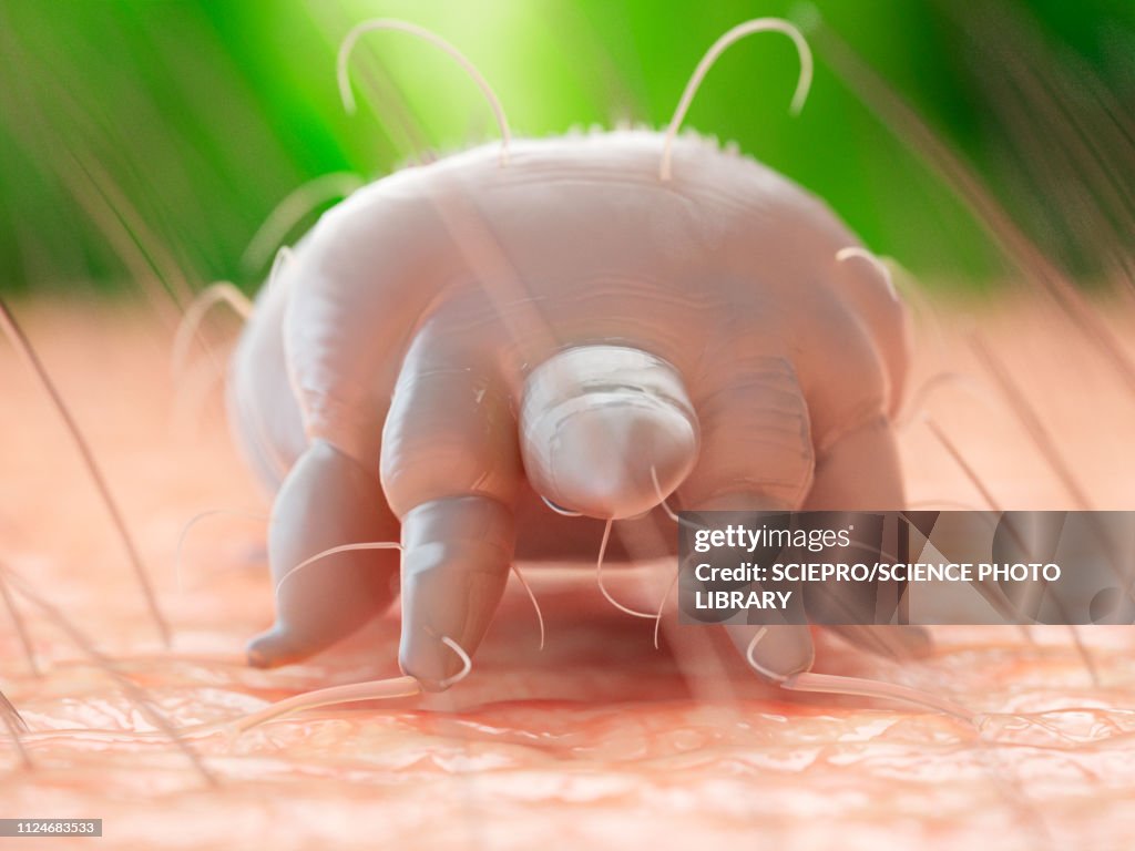 Illustration of a scabies mite on human skin