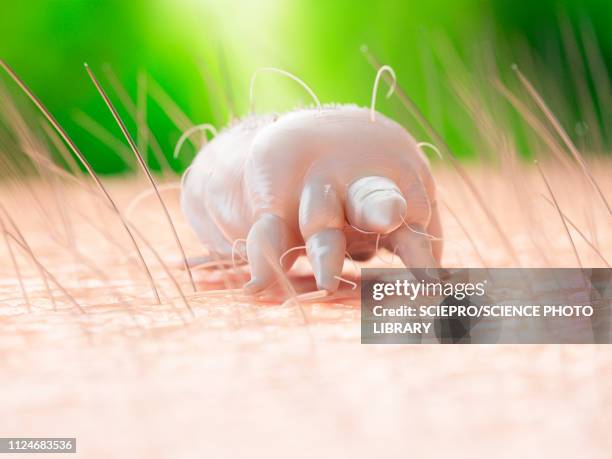 illustration of a scabies mite on human skin - scabies stock illustrations