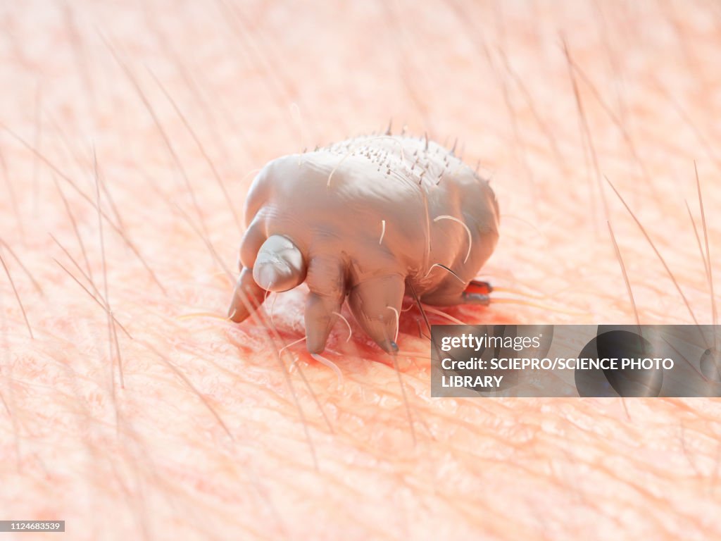 Illustration of a scabies mite on human skin