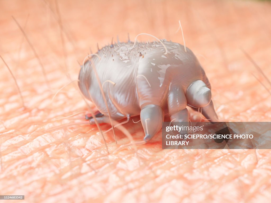 Illustration of a scabies mite on human skin