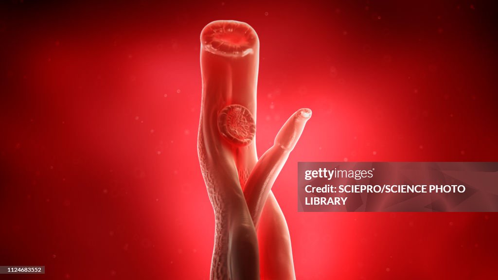 Illustration of a schistosoma