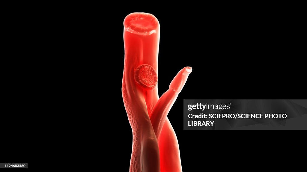 Illustration of a schistosoma