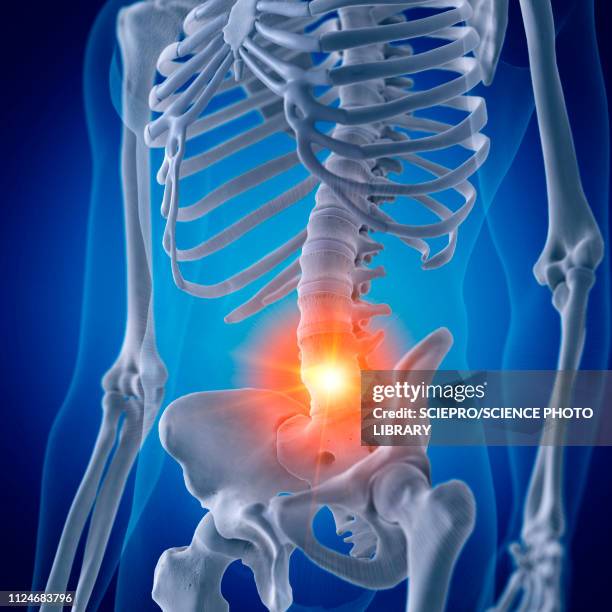 Lumbar Rfl 1,673 Lumbar Spine Anatomy Stock Photos, High-Res Pictures, and Images ...