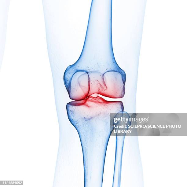 ilustrações, clipart, desenhos animados e ícones de illustration of the knee bones - fêmur