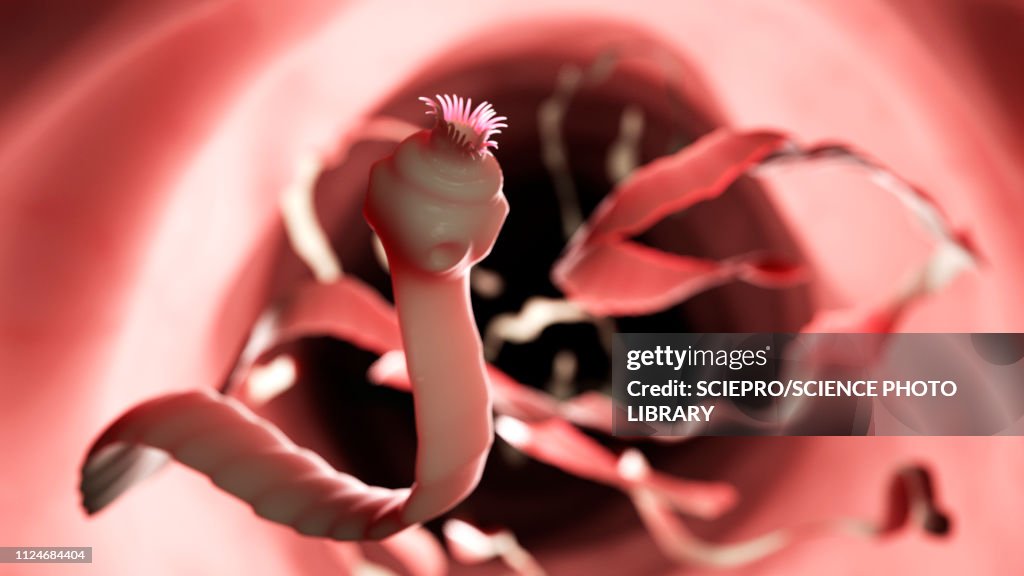 Illustration of a tapeworm
