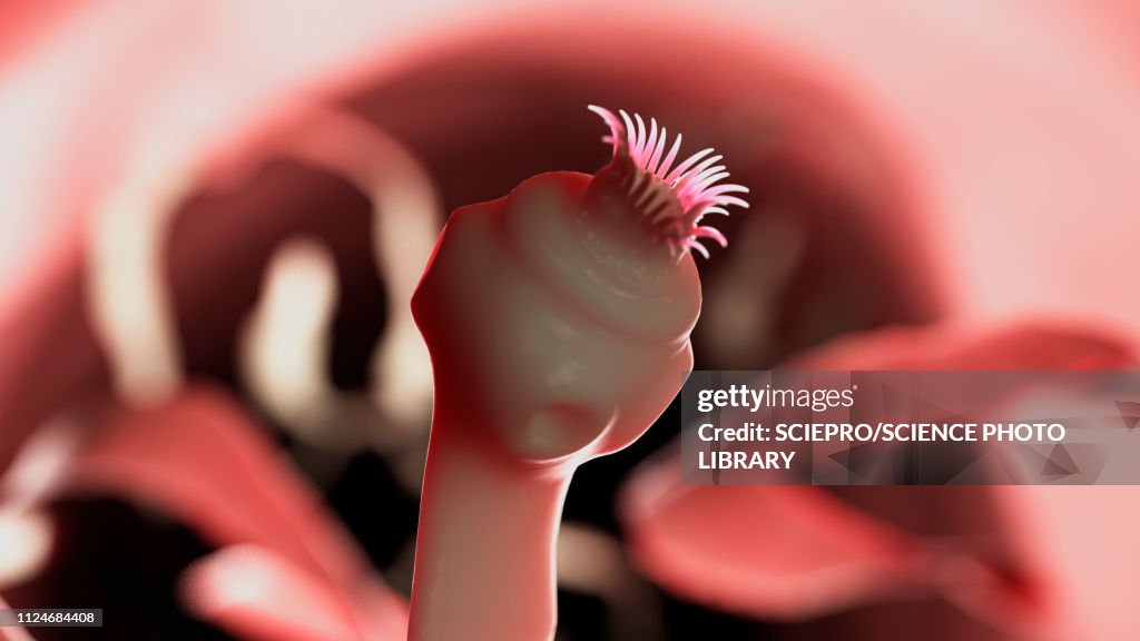 Illustration of a tapeworm