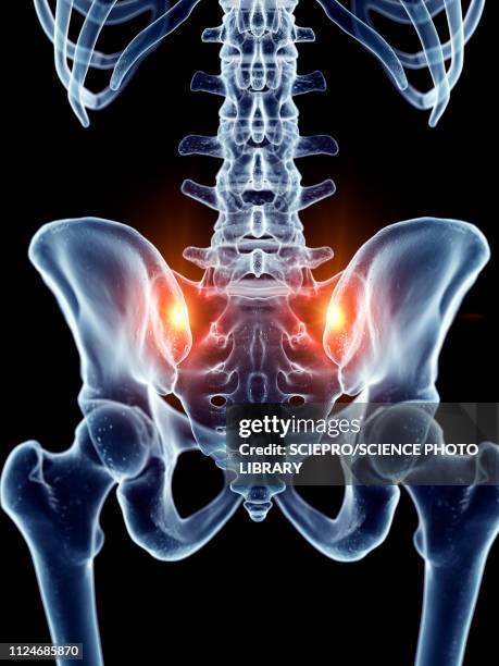 illustration of painful sacrum joints - sacrum photos et images de collection