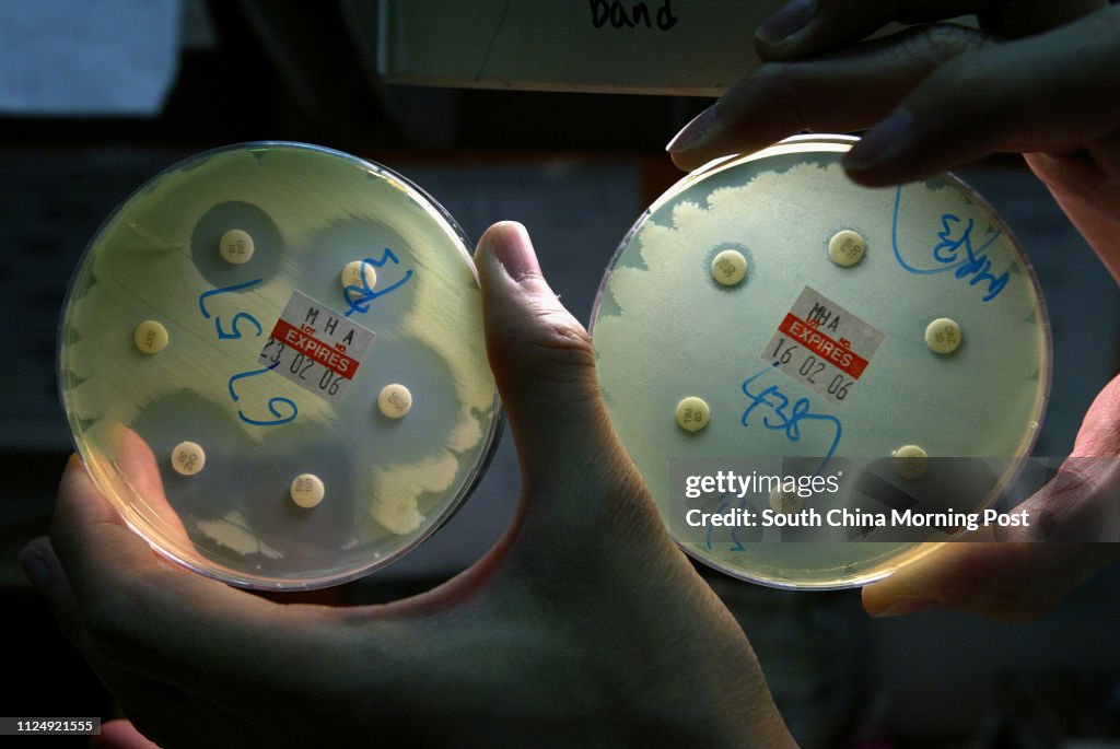 (left) the culture of bacteria called Pseudomonas aeruginosa which have no drug resistance feature, the bacteria, as shown in the disc, could not grow near the dots were soaked with antibiotics. (right) the Pseudomonas aeruginosa which are resistant to th