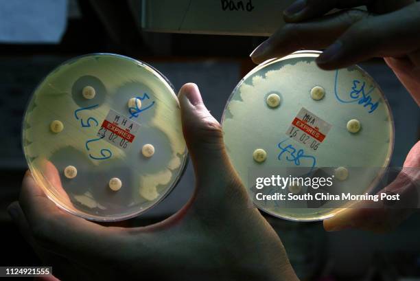 The culture of bacteria called Pseudomonas aeruginosa which have no drug resistance feature, the bacteria, as shown in the disc, could not grow near...