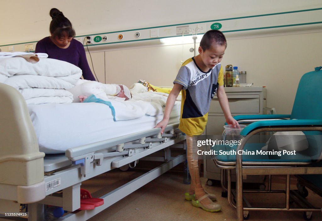 Li Haoren is pictured  at the PLA 304 Hospital in Beijing on Jul. 17, 2013. The two boys, Li Haoren, eight years old, and his younger brother Li Hao, 4 four years old, were badly burnt after imitating what they saw on the cartoon Pleasant Goat and Big Big