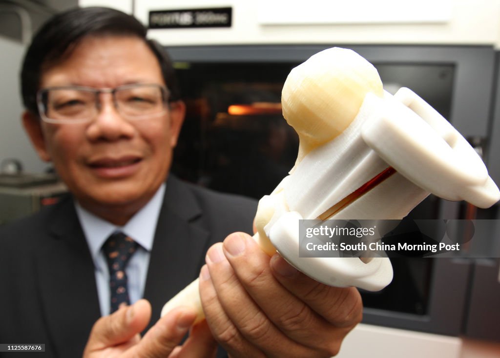 Ir Raymond Chan Kin-sek, president of The Hong Kong Institution of Engineers (HKIE) holds a  Educational illustration for designing skull implant customised by adopting 3D printing, during a media Tour about 3D Printing Technology in Biomedical Engineerin