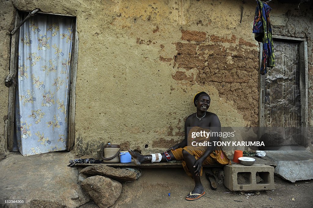 Nigerian, Ngo Kande, 58, nurses a leg in