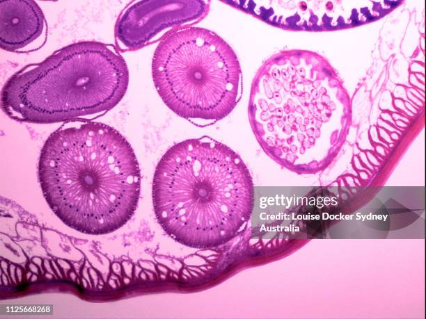 a partial cross section of a worm under a microscope - microbiologie stock-fotos und bilder