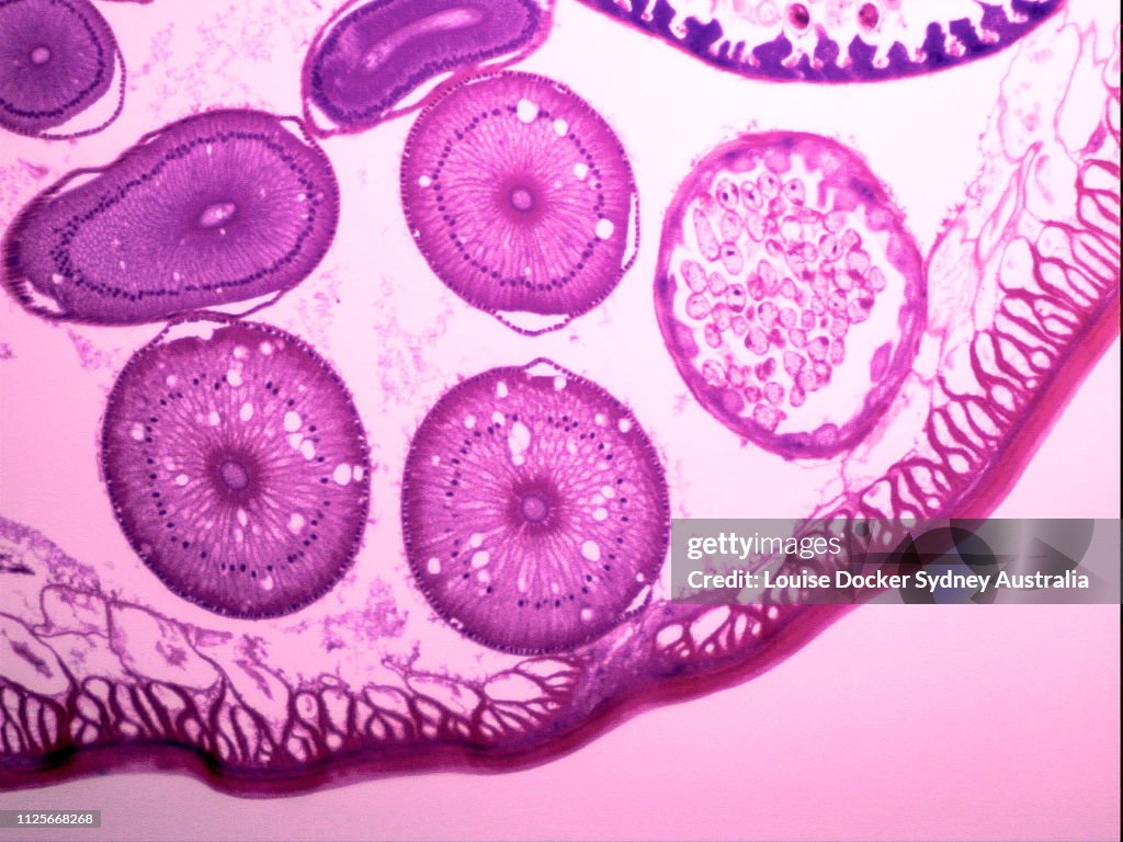 A partial cross section of a worm under a microscope