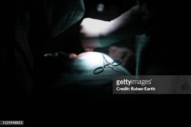 scissors in the operating room - operating room background stock pictures, royalty-free photos & images