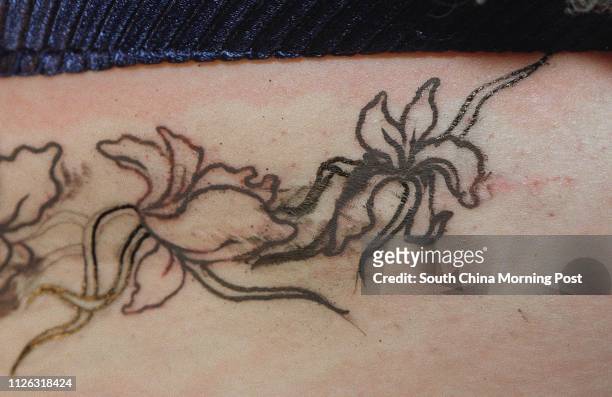 Pix shows the scar and partially-completed tattoo that covers the hip operation scar on Jennifer Hyman. Ralstonchina PICTURE BY MARK RALSTON