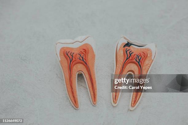 caries teeth - tooth root stock pictures, royalty-free photos & images