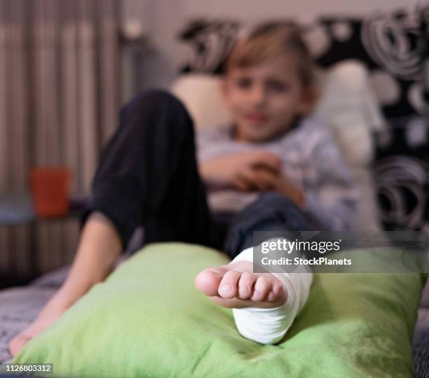 a boy with a broken leg - ankle sprain imagens e fotografias de stock