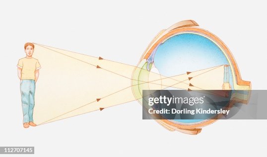 Eye Vision Example Illustration Of Vision Of The Human Eye High-Res Vector Graphic - Getty ...