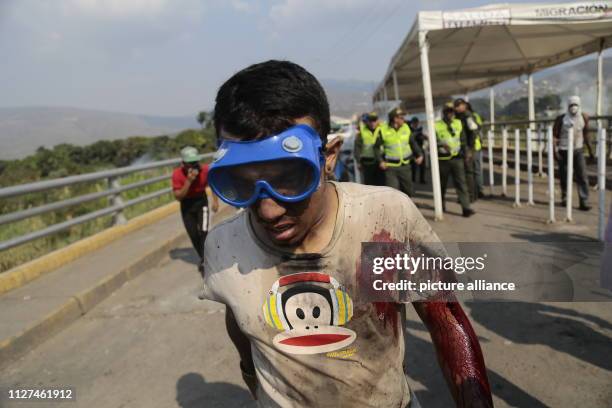 Dpatop - 25 February 2019, Colombia, Cucuta: A demonstrator injured in clashes on the Simon Bolivar bridge on the border between Colombia and...