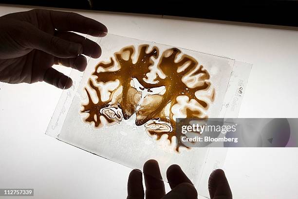 Half Brain Photos and Premium High Res Pictures - Getty Images