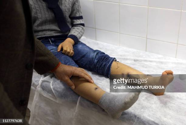 Boy receives treatment for Leishmaniasis at the Bir Al-Ostah Milad Hospital for Dermatology in the Libyan capital, Tripoli on February 11, 2019.