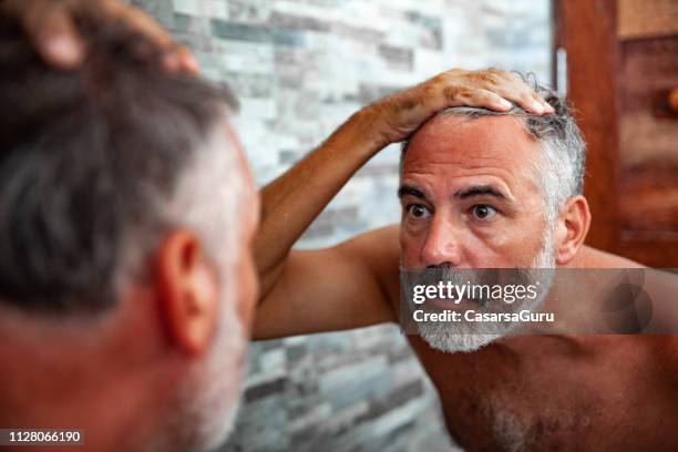 sunburned mature man looking into the mirror in the bathroom - sunburnt stock pictures, royalty-free photos & images