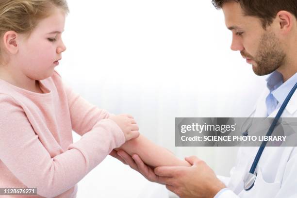 doctor examining girl's arm - allergy doctor stockfoto's en -beelden