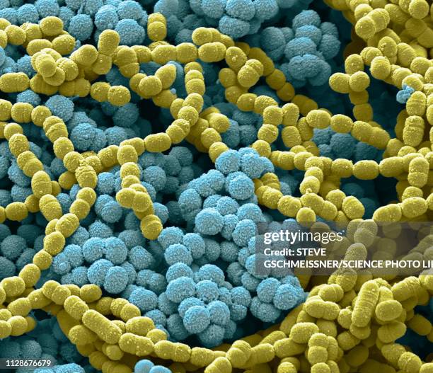 sputum culture, sem - streptococcus fotografías e imágenes de stock