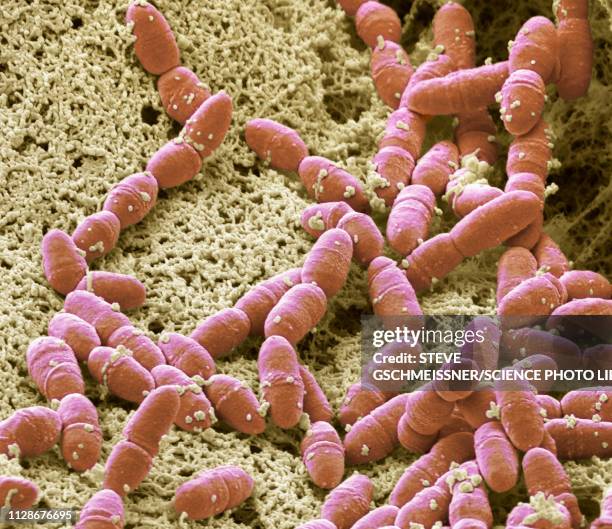 streptococcus mutans, sem - streptococcus mutans 個照片及圖片檔