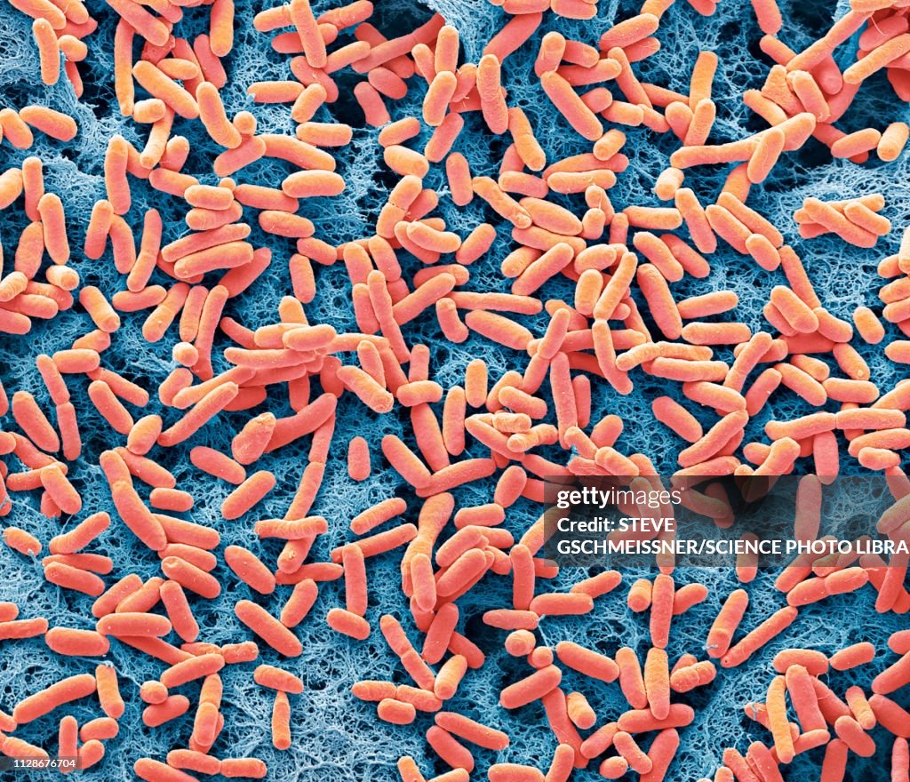 E coli, SEM
