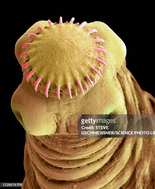 tapeworm cysticercus, sem - tapeworm stockfoto's en -beelden