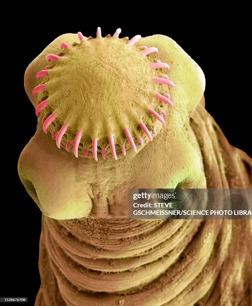 Tapeworm cysticercus, SEM