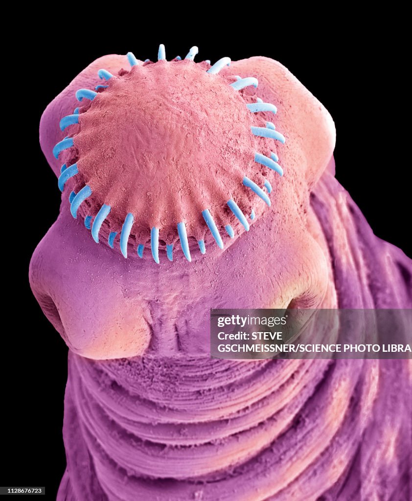 Tapeworm cysticercus, SEM