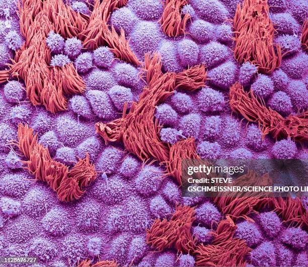 fallopian tube, sem - microscopio elettronico a scansione foto e immagini stock