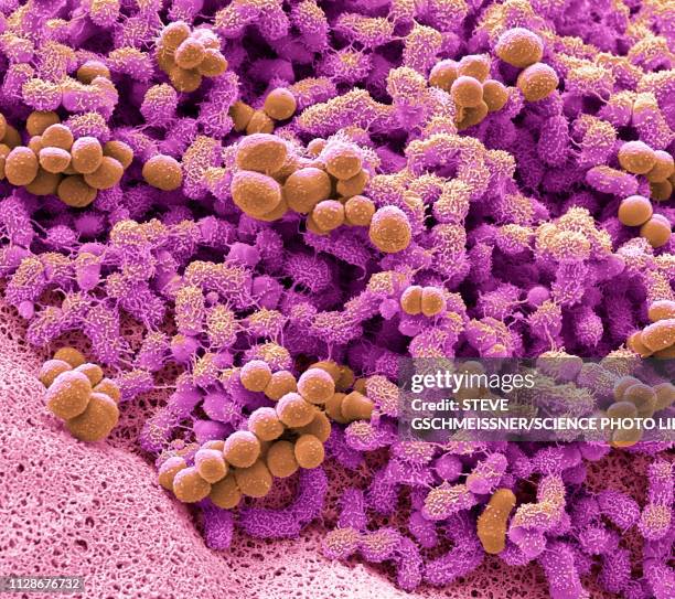 foot bacteria, sem - bacteria cultures stock pictures, royalty-free photos & images