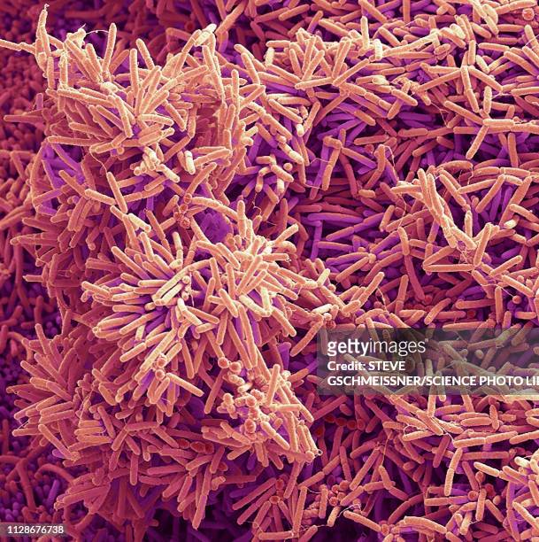 plaque-forming bacteria, sem - micrografia elettronica a scansione foto e immagini stock