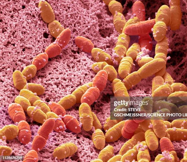 streptococcus mutans, sem - streptococcus mutans 個照片及圖片檔