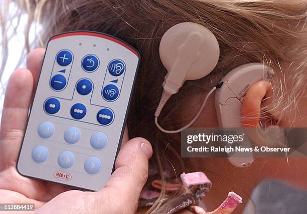 Detailed view of the new remote hand tuner unit for the cochlear implant is worn by pediatric hearing patient Rachel Skergan at the CCCDP offices in...