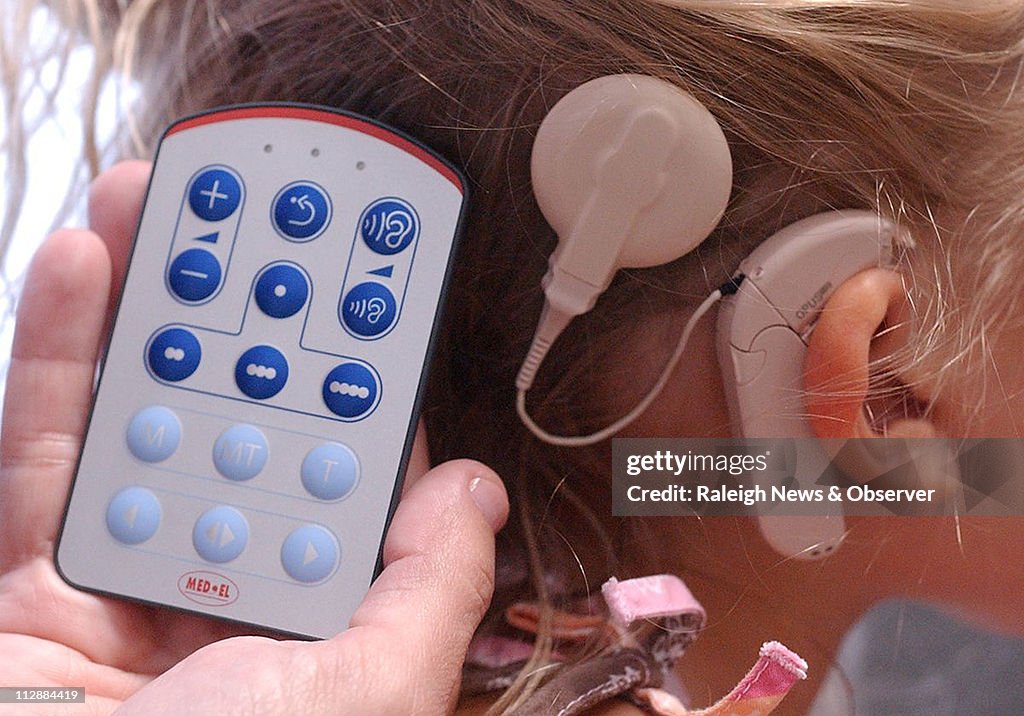 MED-COCHLEARIMPLANTS