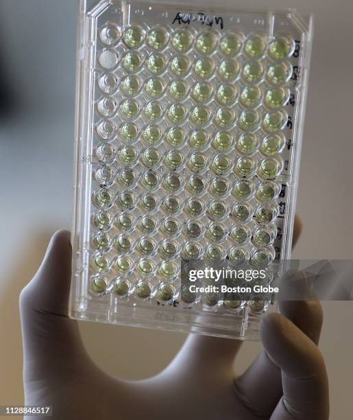 Well plate with MTT assay of breast cancer and healthy cells is held up at Scott Robinson's rented laboratory bench in Cambridge, MA on Feb. 20,...