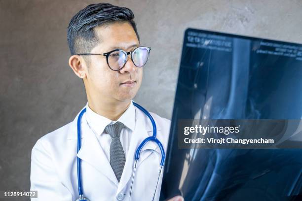 doctor looking film x-ray skeleton knee in the lab - asia surgery stock pictures, royalty-free photos & images