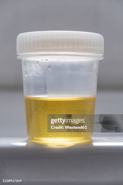 urine sample in a cup - urine sample fotografías e imágenes de stock