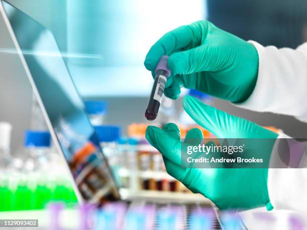 healthcare screening, researcher examining blood sample and checking with the data on laptop computer, close up of hands - advance 2018 exam stock pictures, royalty-free photos & images