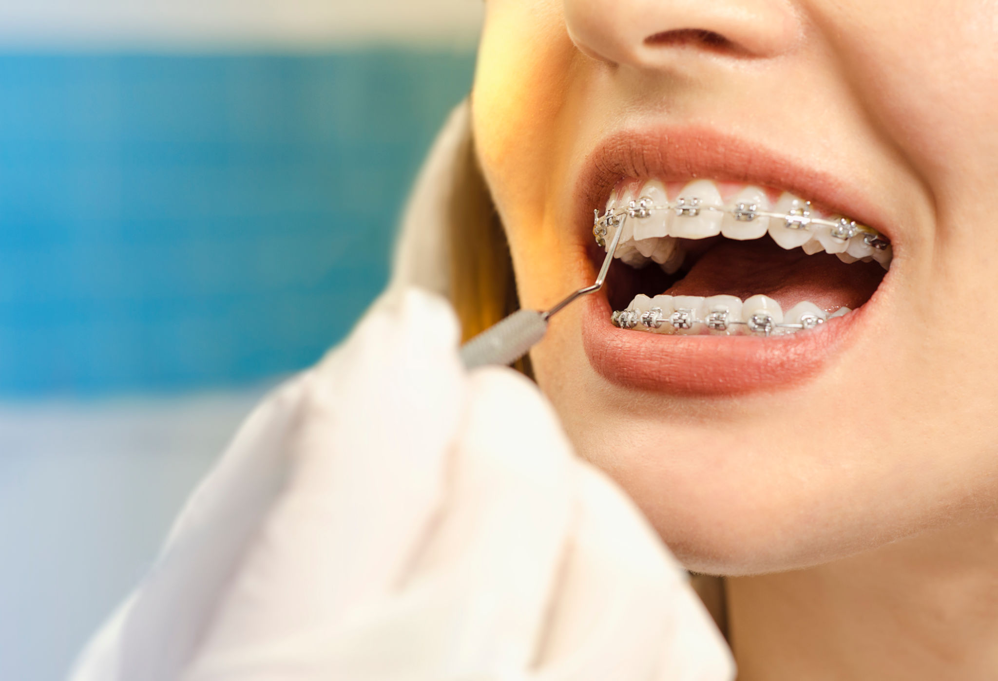 orthodontic care