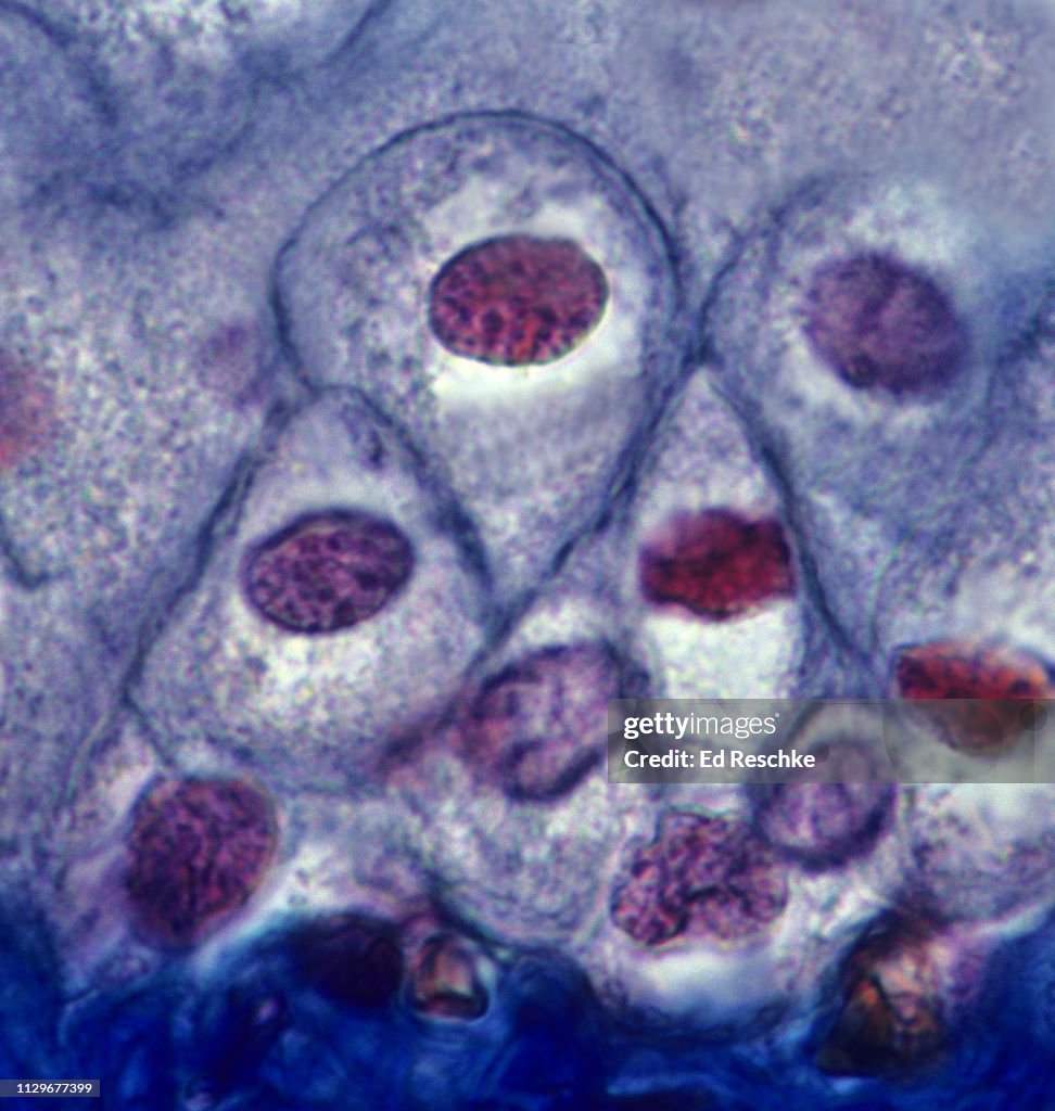 TRANSITIONAL EPITHELIUM, URINARY BLADDER, 400X