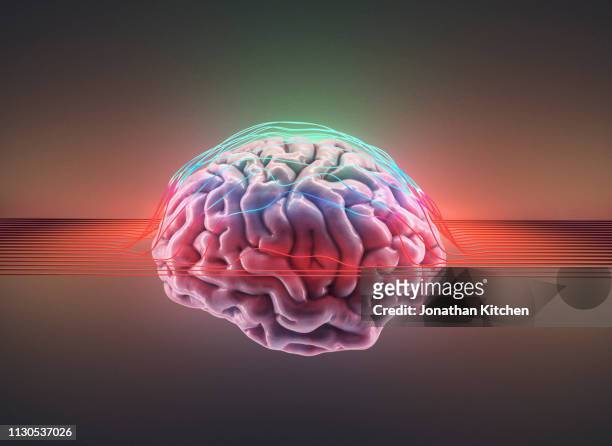 Brain with wires