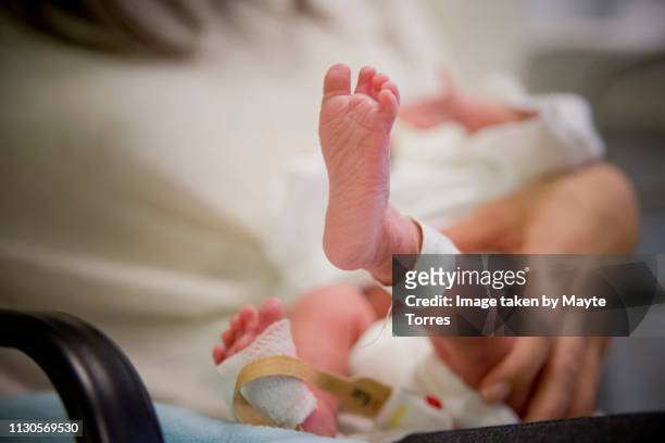 premature newborn leg - soltanto un neonato maschio foto e immagini stock