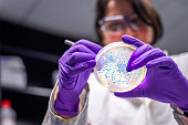 woman researcher performing examination of bacterial culture plate