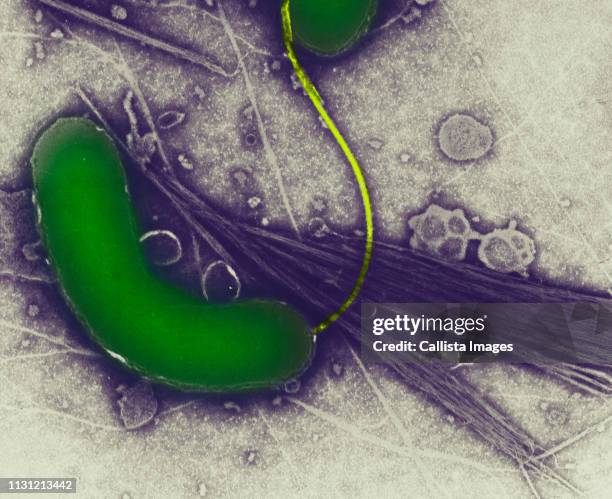 scanning electron micrograph of cholera bacteria - cholera stock pictures, royalty-free photos & images